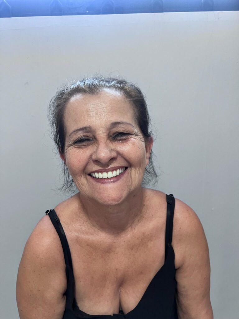 Prótese protocolo ou dentadura: qual a diferença?